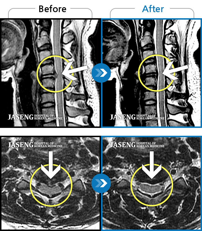 õڻѹ溴 ġ MRI ġ- ްϰ İ~ ־.