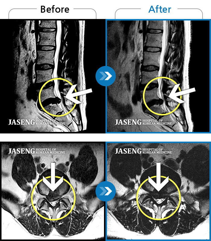 дڻѹ溴 ġ MRI  ġ-     ġῡ ȣ  ٸ