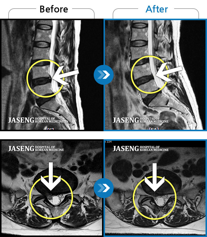 ڻѹ溴 ġ MRI  ġ-Ͽߺ
