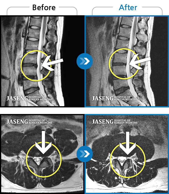 дڻѹ溴 ġ MRI  ġ- ħ뿡  ϰ  ߰ ϻȰ Ұߴ