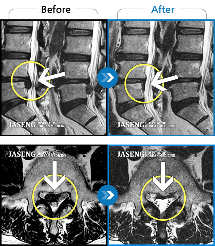 õڻѹ溴 ġ MRI ġ-ϻȰ , ~Ƹ ؽ ־