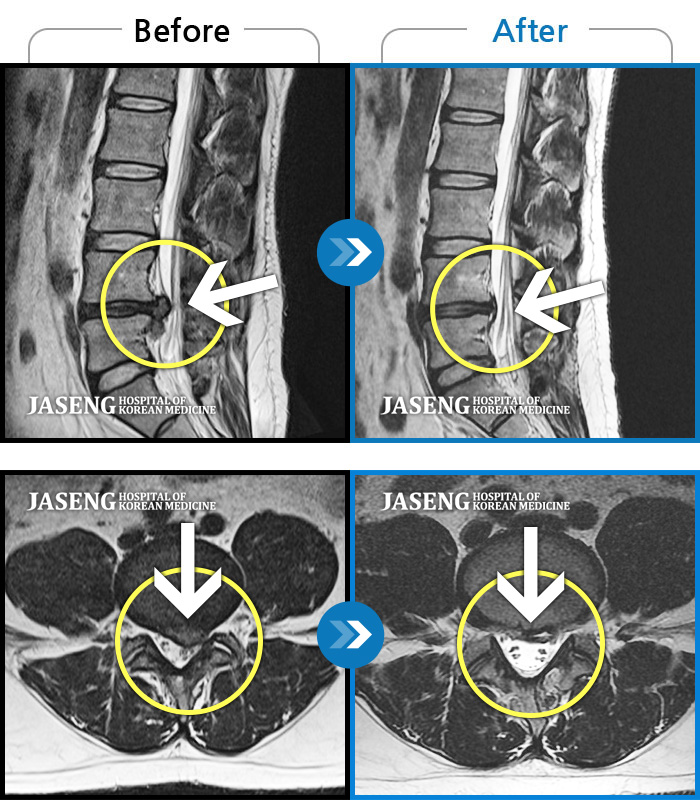 õڻѹ溴 ġ MRI ġ-㸮 , ٸ ־.