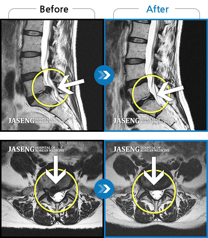 õڻѹ溴 ġ MRI ġ- 㸮 , кο ٸ ־.