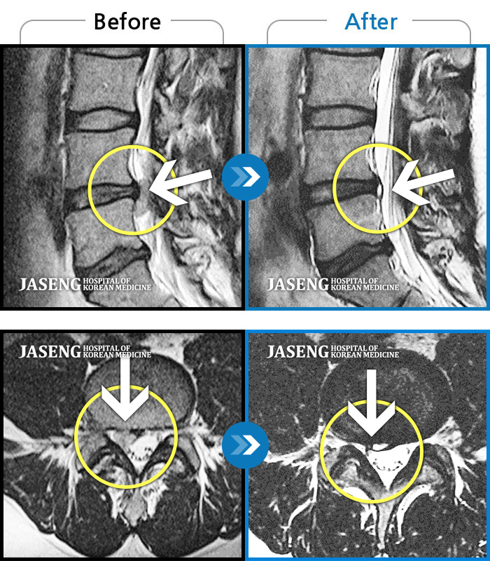õڻѹ溴 ġ MRI ġ-㸮 , ٷϰ ־.