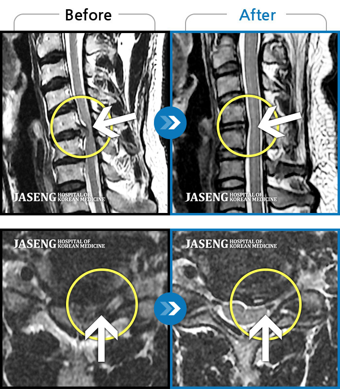 õڻѹ溴 ġ MRI ġ-ڰ Ͼ ؽ İ Ϻ