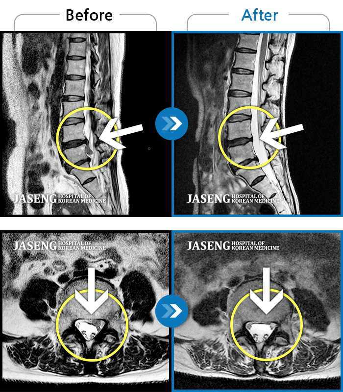 ڻѹ溴 ġ MRI ġ-㸮̶ ߸~ߵ . ߰ , ־.