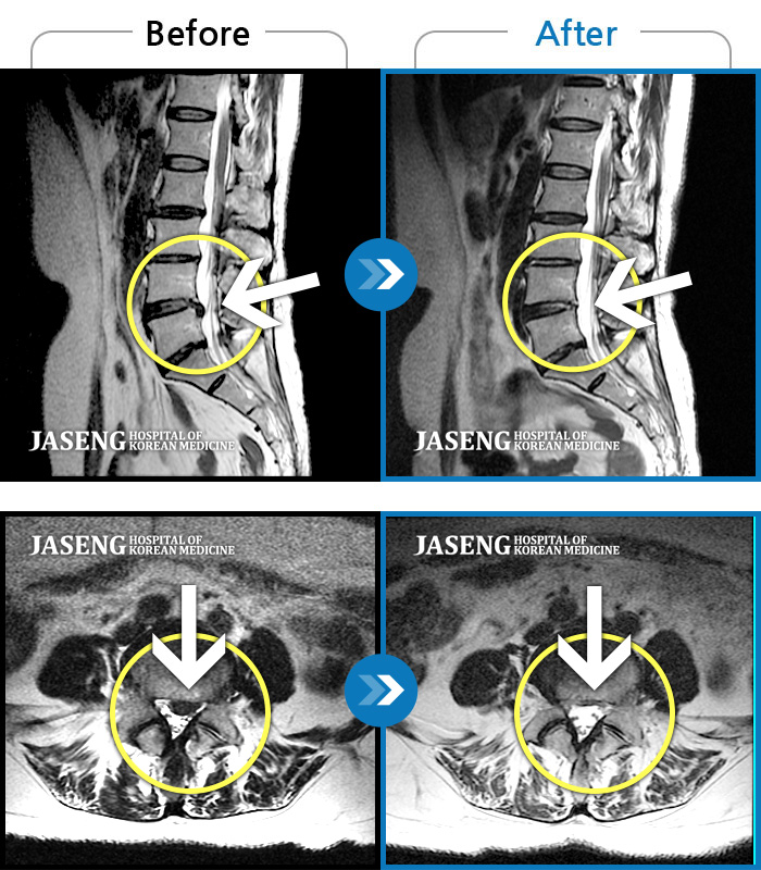 Ȼڻѹ溴 ġ MRI ġ-߸ ҰŸ鼭 ɾ.