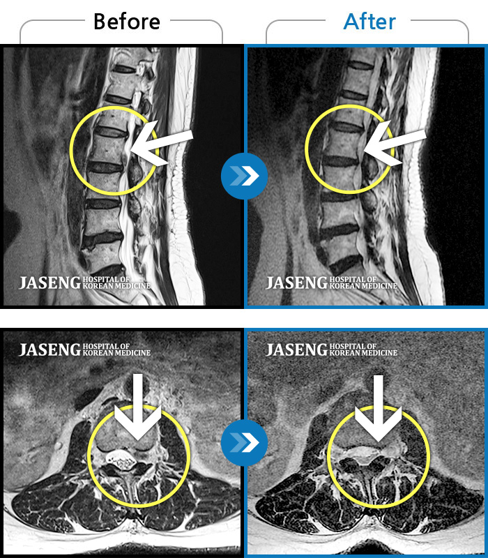 ϻڻѹ溴 ġ MRI  ġ-ó   㸮    ,  ٸ   ϰ ־  Ȱ , ߰ ᵵ  ڰ  Ͽ  Ȱ  ¼̽ϴ.