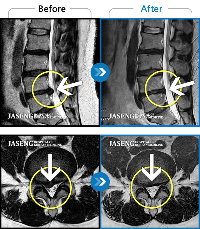 ڻѹ溴 ġ MRI ġ-㸮 ٸ Ұ߽ϴ.