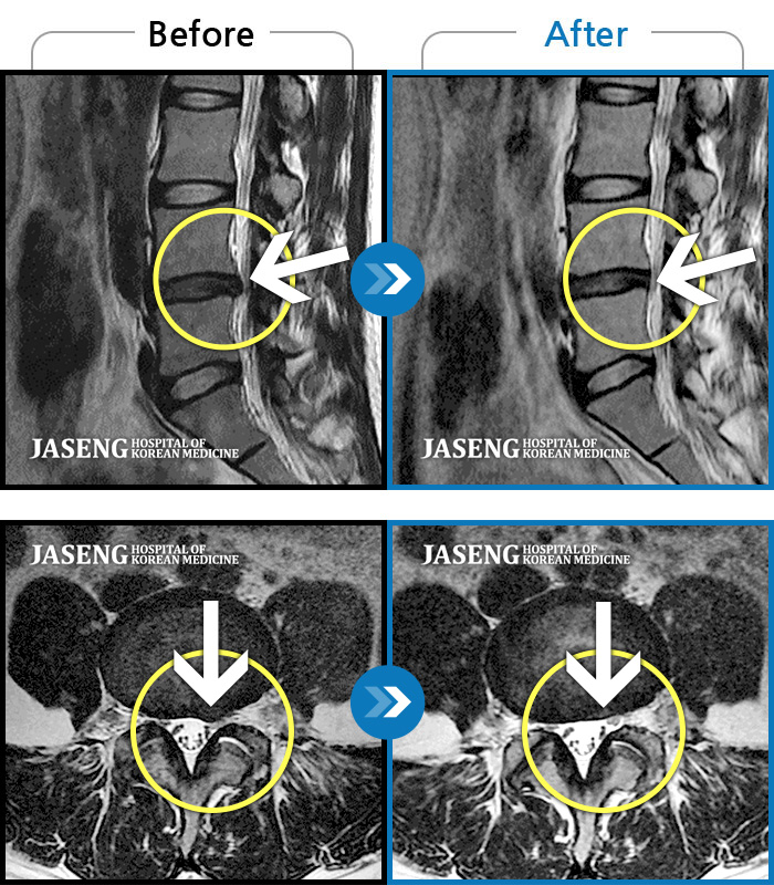 ڻѹ溴 ġ MRI ġ-㸮, , ٸ Ȱ Ұ