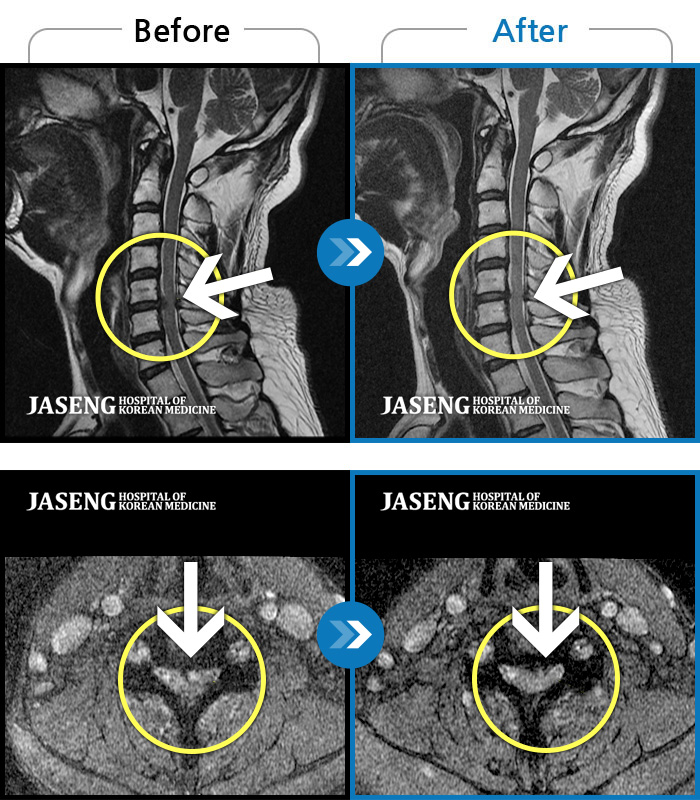 дڻѹ溴 ġ MRI  ġ-   ༺ ũ ĿǾ ؽ     ,  հ   ȣϿ