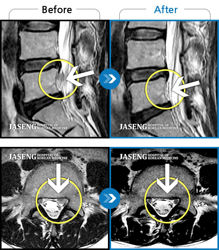õڻѹ溴 ġ MRI ġ- ö ݺ ؽ Ͽ
