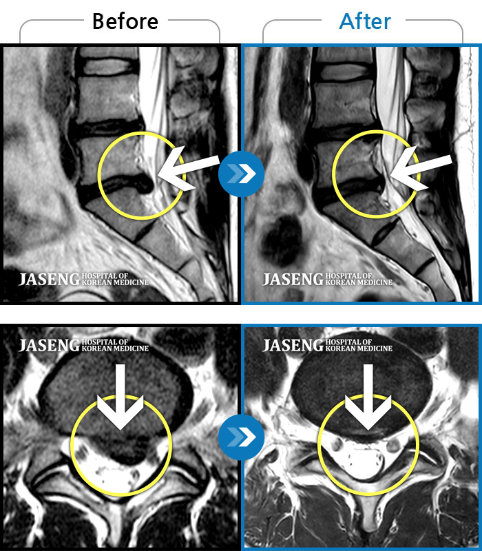 ڻѹ溴 ġ MRI ġ-Ⱓ ӵǾ 㸮 ֱ ġῡ ʰ .