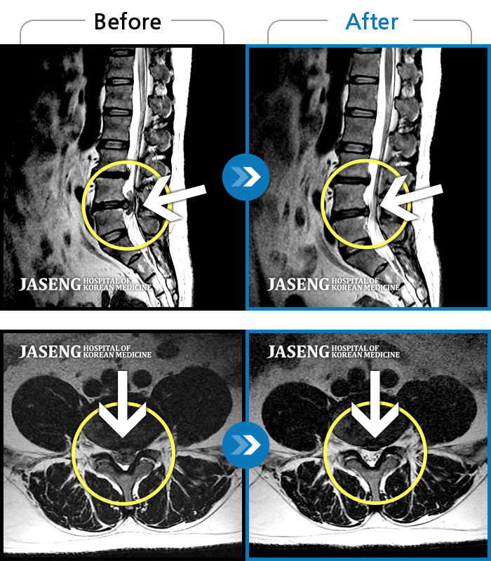 ڻѹ溴 ġ MRI ġ- ٸ ؼ ɾٴϱ