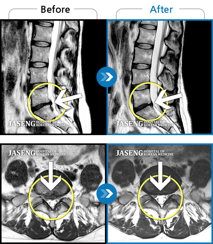 ڻѹ溴 ġ MRI ġ- ȸ Ȱ 㸮 ٸ