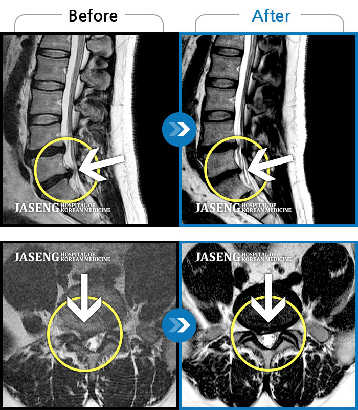 ڻѹ溴 ġ MRI ġ- Ƹ ʹ ؼ ް Ծ