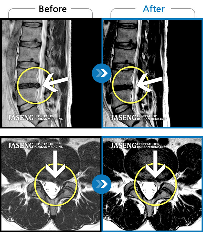 ڻѹ溴 ġ MRI ġ- ߴ 㸮 ũ ٽ