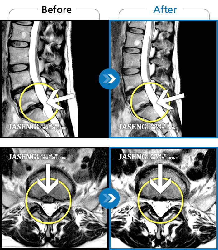 ڻѹ溴 ġ MRI ġ- 㸮 ֱٿ
