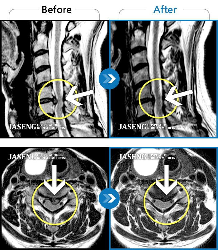 ڻѹ溴 ġ MRI ġ- ؿ