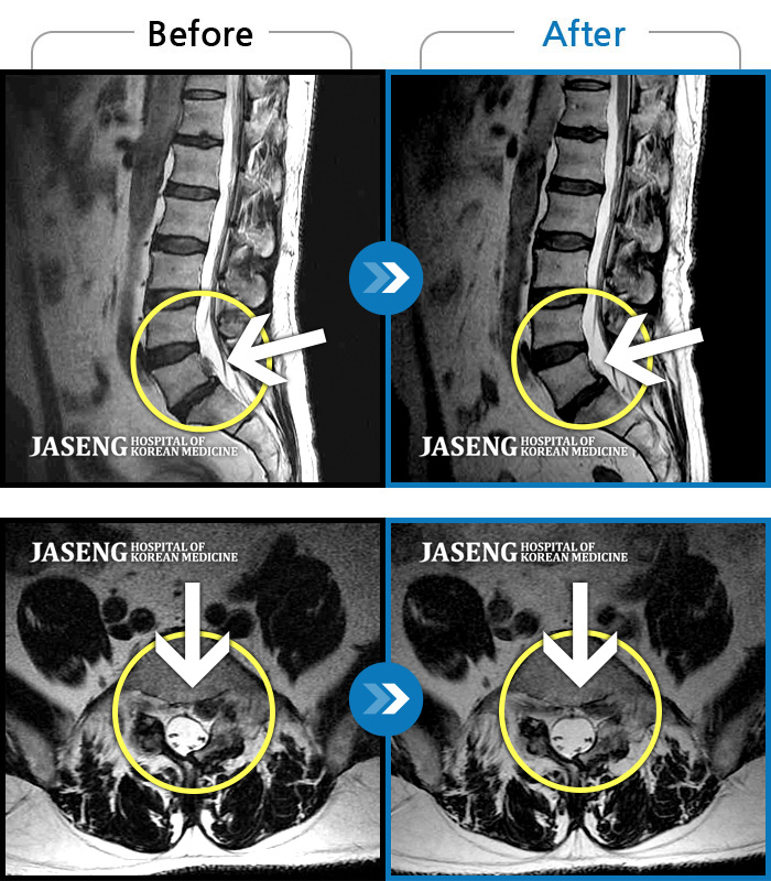 ڻѹ溴 ġ MRI ġ-ġ ٸ ſ ؿ.