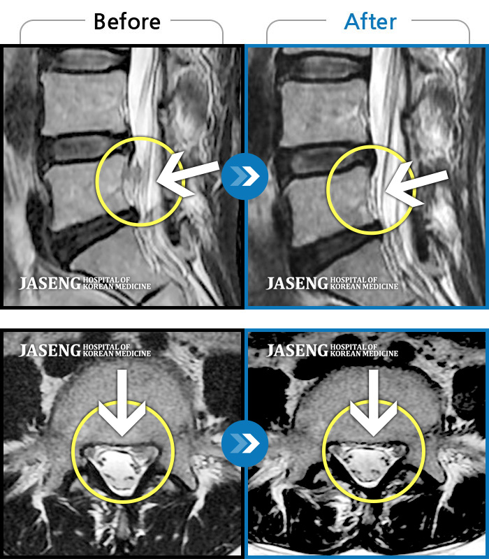õڻѹ溴 ġ MRI ġ-Ǫ ݺ ؽ Ͽ
