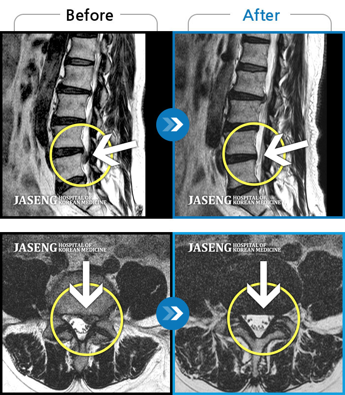 õڻѹ溴 ġ MRI  ġ-2023.12濡 濡 ȴٰ ߲   㸮   Դϴ.