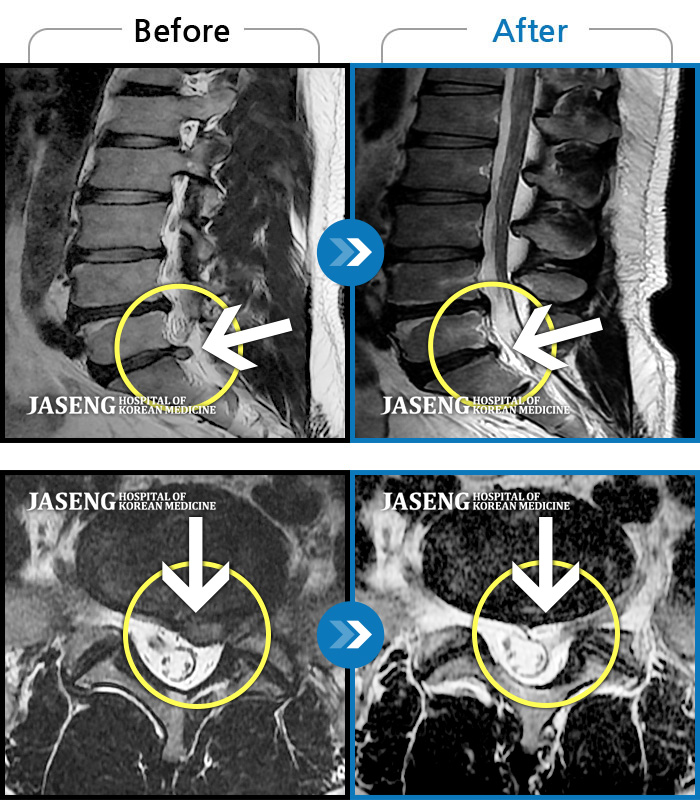 ؿڻѹ溴 ġ MRI  ġ-    Ǿ ϻȰ ʹ ̽ϴ.