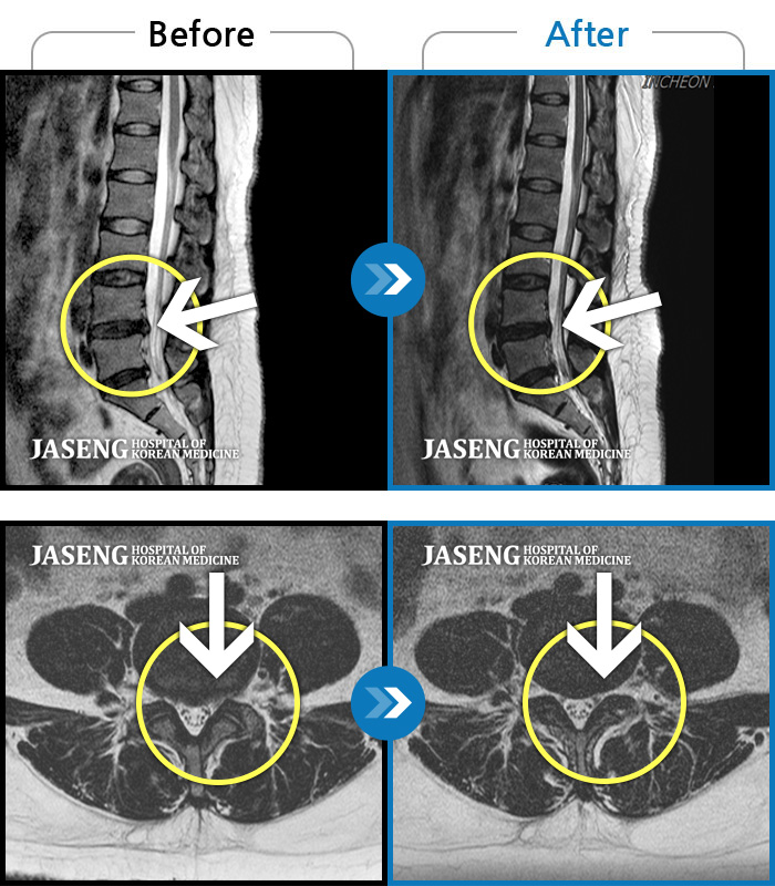 õڻѹ溴 ġ MRI  ġ-ؽ  㸮 ݵ ̱ ,    