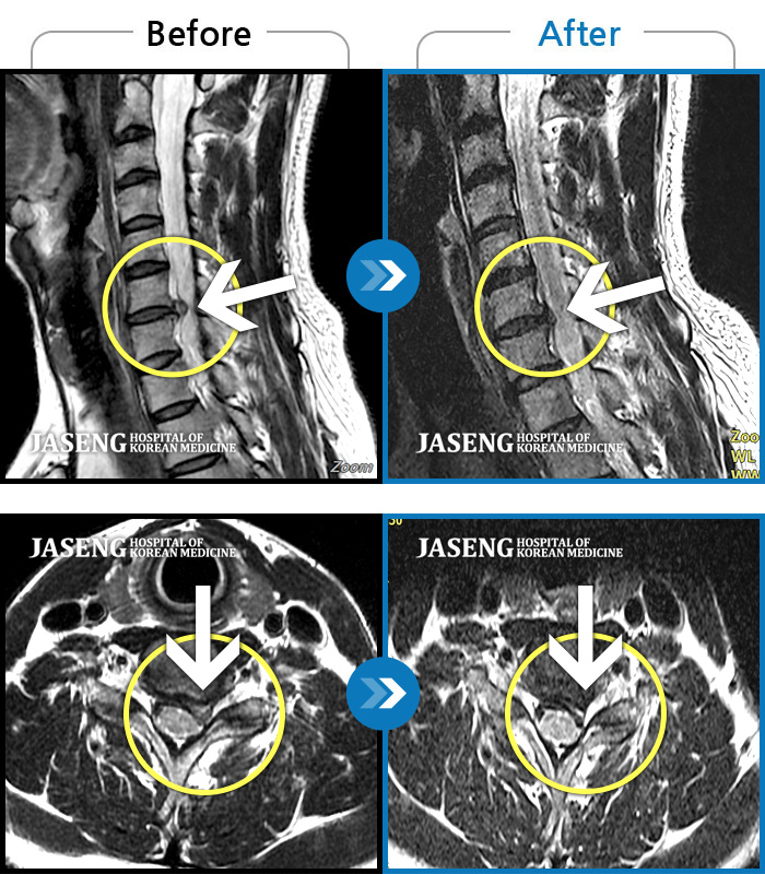뱸ڻѹ溴 ġ MRI  ġ- , ,    ϻȰ , ߰ ϴ