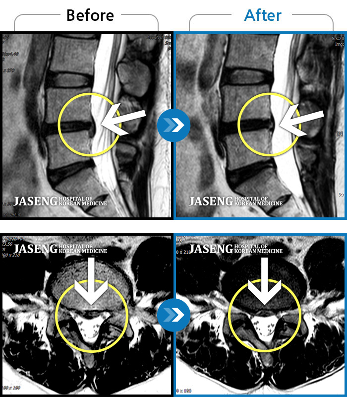 ڻѹ溴 ġ MRI ġ-㸮 ؼ ̱ ư ϴ.
