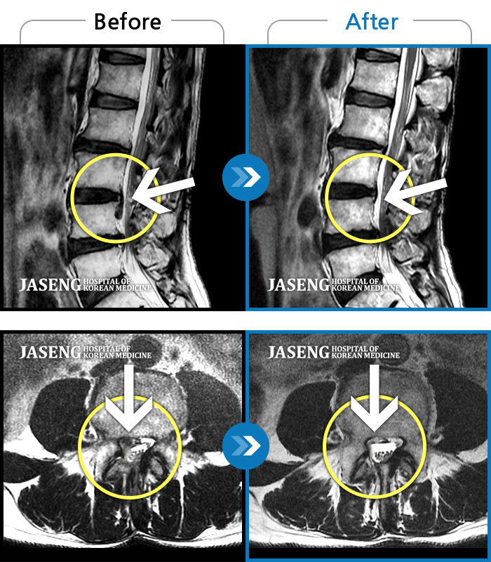 ڻѹ溴 ġ MRI  ġ- Ͽߺ