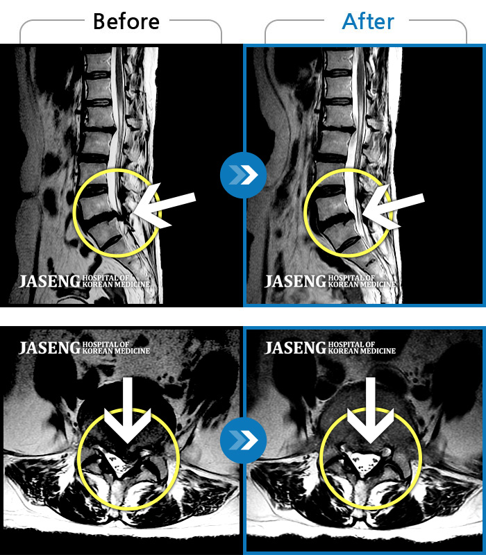 ڻѹ溴 ġ MRI ġ- к, ٸ ̾ ° · Ͻ ȯںԴϴ.