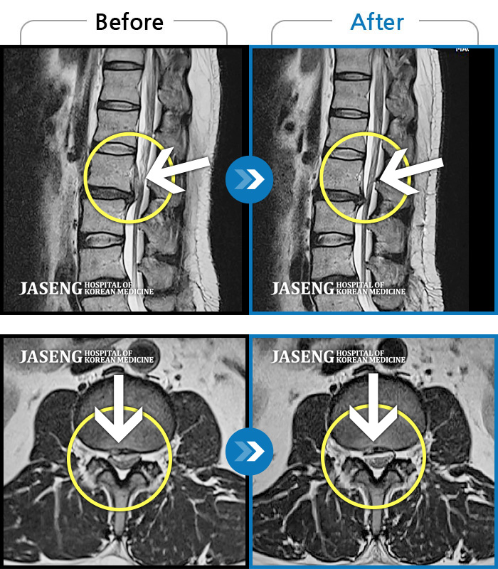 뱸ڻѹ溴 ġ MRI  ġ- 㸮 Ⱑ ư  ٸ   ƴ.