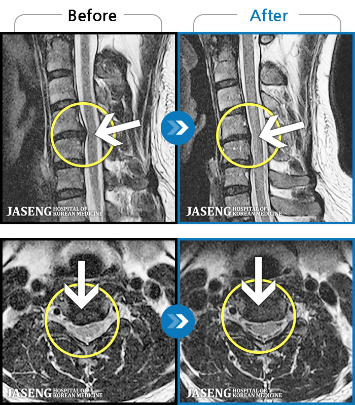 뱸ڻѹ溴 ġ MRI  ġ- , , ȿ   ϻȰ  ־ϴ.