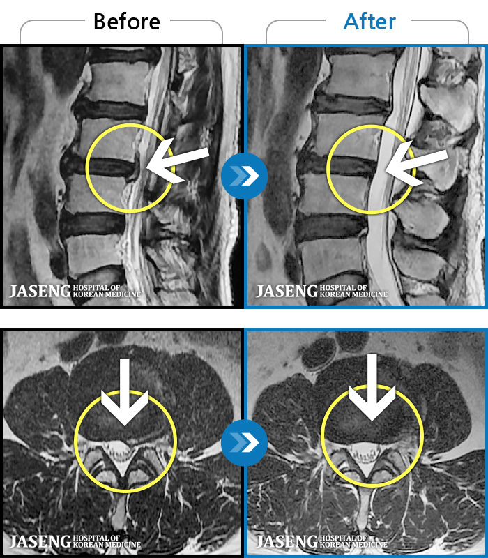 ؿڻѹ溴 ġ MRI  ġ-㸮   ְ 㸮   մϴ.