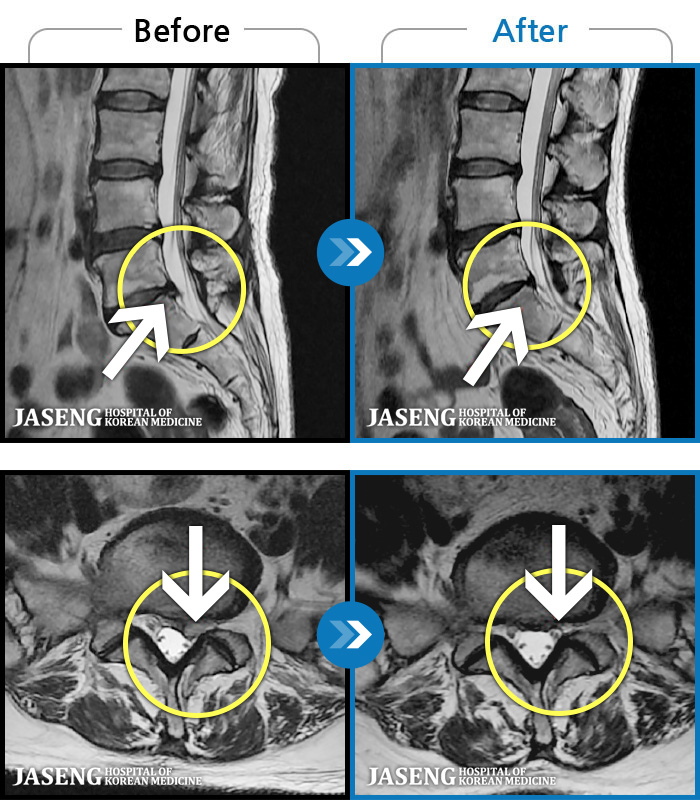 ڻѹ溴 ġ MRI ġ- ɰϿ Ұ ¿ ϼ̽ϴ.