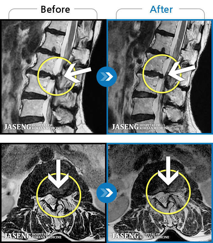 ؿڻѹ溴 ġ MRI  ġ-㸮 ϰ