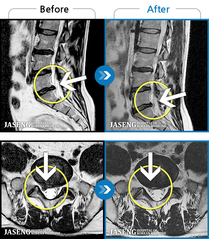 ϻڻѹ溴 ġ MRI  ġ- ݺ   ӵǸ ڼ ÿ   ȭǴ ߵ ̻  ȣϴ ¿ϴ.