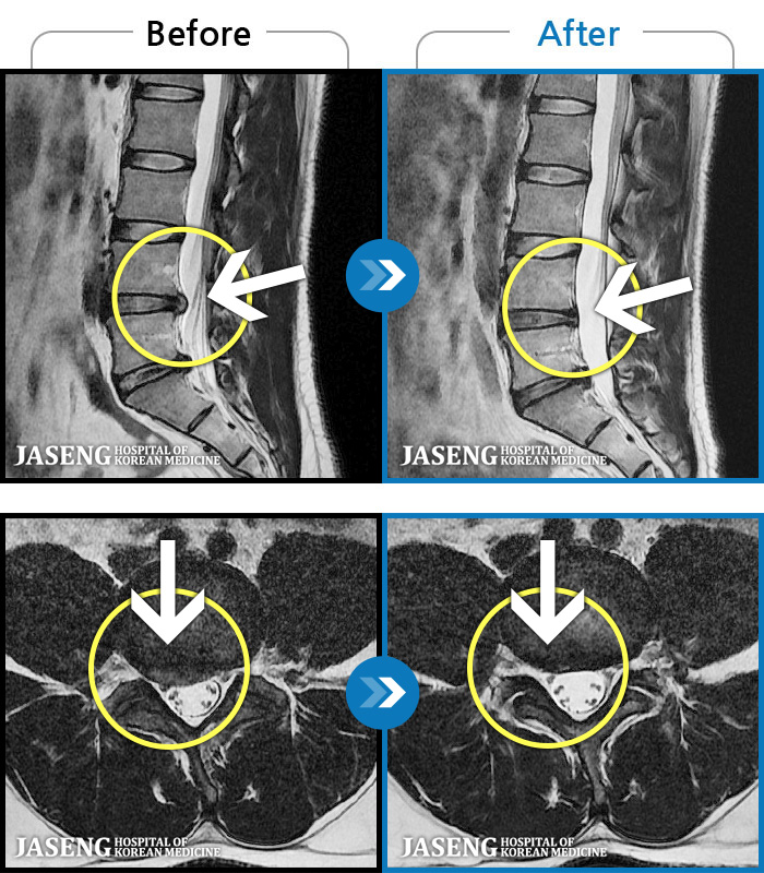 ڻѹ溴 ġ MRI  ġ- 㸮 㸮 ̸   ִ.