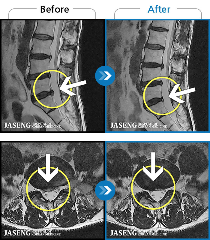 ڻѹ溴 ġ MRI  ġ-   ϰ     ӵǾϴ. ߰ Ͽ ߰   Ǵ  ߵ ̻  ȣϴ ¿ϴ.