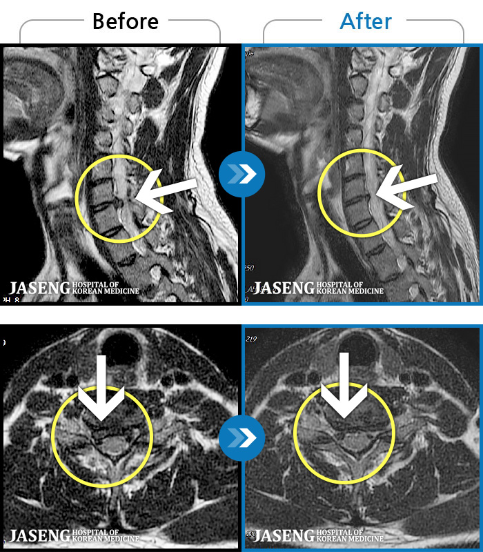 õڻѹ溴 ġ MRI ġ- Ͽϴ.