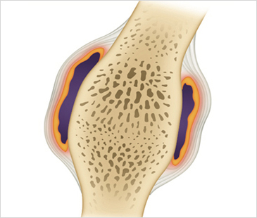 ûڻѹ溴 Ÿȯ Ƽ-Ƽ