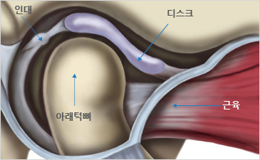 뱸ڻѹ溴 ȯ ΰ- δ ũ, Ʒλ,  ̴  Դϴ.