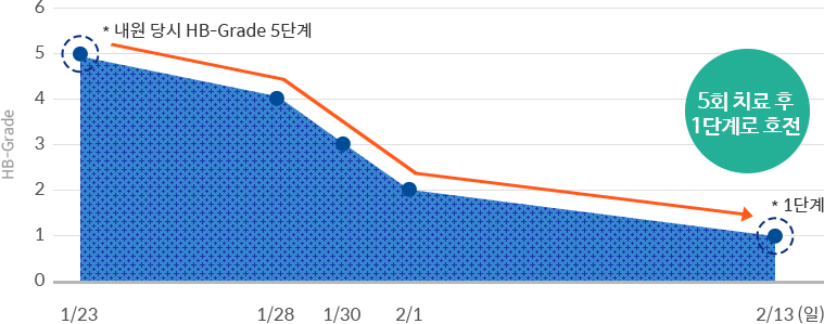 ġῡ  ȸŰ渶 ܰ(HB-Grade) ȭ ׷ ̹