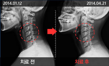 ڻѹ溴 ûҳô ΰ&ȸĪ- ġ   ̹