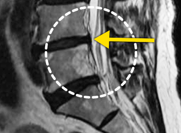 ڻġ MRI ̹ Դϴ.