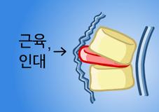 ڻѹ溴 ġ ŹٷѾ -Ƣ ũ , δ밡   پ ȸǴ ̹ Դϴ.